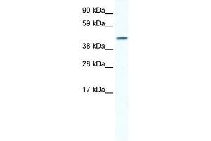 GJA5 antibody used at 1 ug/ml to detect target protein.