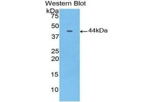 Western Blotting (WB) image for anti-Gastrointestinal Cancer Antigen CA19-9 (CA 19-9) (AA 35-361) antibody (ABIN5661981) (CA 19-9 antibody  (AA 35-361))