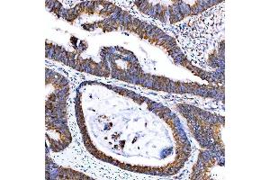 IHC analysis of SUMF2 using anti-SUMF2 antibody (ABIN7600954). (SUMF2 antibody  (AA 26-301))