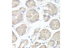 Immunohistochemistry of paraffin-embedded human stomach using CLUH antibody  at dilution of 1:100 (40x lens). (CLUH antibody  (AA 1120-1309))