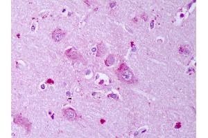Anti-GABRB1 antibody IHC of human brain, cortex neurons. (GABRA1 antibody  (AA 327-450))