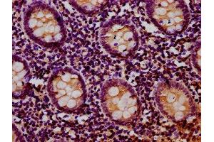 IHC image of ABIN7169168 diluted at 1:400 and staining in paraffin-embedded human appendix tissue performed on a Leica BondTM system. (RIOK2 antibody  (AA 316-448))