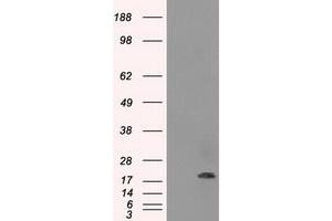 Image no. 1 for anti-Crystallin, alpha B (CRYAB) antibody (ABIN1497644) (CRYAB antibody)