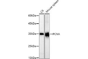 Western blot analysis of extracts of various cell lines, using PCNA antibody (ABIN6133630, ABIN6139020, ABIN6139022 and ABIN7101400) at 1:1000 dilution. (PCNA antibody)