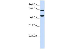 WB Suggested Anti-TRIM54 Antibody Titration:  0. (TRIM54 antibody  (N-Term))