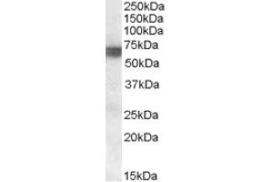 Image no. 1 for anti-Bridging Integrator 1 (BIN1) (Internal Region) antibody (ABIN375175) (BIN1 antibody  (Internal Region))