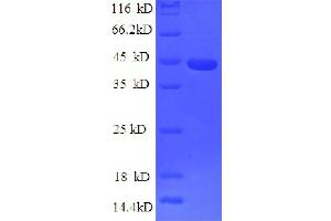 Leptin (LEP) (AA 29-164), (partial) protein (GST tag) (Leptin Protein (LEP) (AA 29-164, partial) (GST tag))