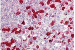 Anti-CLIC4 antibody IHC staining of human spleen. (CLIC4 antibody  (AA 1-50))