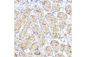 Immunohistochemistry of paraffin-embedded rat kidney using Aquaporin-1  Rabbit pAb (ABIN7265651) at dilution of 1:100 (40x lens). (Aquaporin 1 antibody  (C-Term))