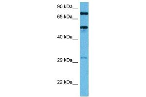 Host:  Mouse  Target Name:  TFE3  Sample Tissue:  Mouse Heart  Antibody Dilution:  1ug/ml (TFE3 antibody  (Middle Region))