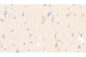 Detection of LDLR in Human Cerebrum Tissue using Polyclonal Antibody to Low Density Lipoprotein Receptor (LDLR) (LDLR antibody  (AA 497-742))