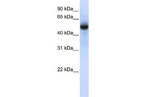 WB Suggested Anti-CXorf34 Antibody Titration:  0. (TRMT2B antibody  (N-Term))
