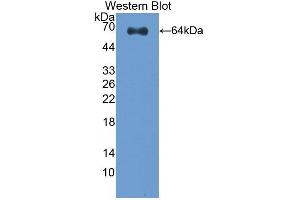 Detection of Recombinant CLEC11A, Human using Polyclonal Antibody to C-Type Lectin Domain Family 11, Member A (CLEC11A) (CLEC11A antibody  (AA 22-323))