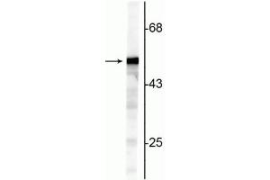 Western blot of NIH 3T3 cell lysate showing specific immunolabeling of the ~50 kDa Vimentin protein. (Vimentin antibody)