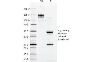 SDS-PAGE (SDS) image for anti-CD2 (CD2) antibody (ABIN6941011)