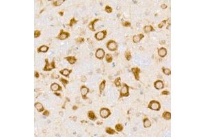 Immunohistochemistry of paraffin-embedded mouse brain using HDLBP Rabbit mAb (ABIN7267644) at dilution of 1:50 (40x lens). (HDLBP antibody)