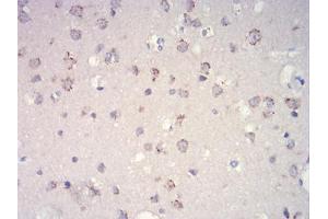Immunohistochemical analysis of paraffin-embedded brain tissues using mTOR mouse mAb with DAB staining. (MTOR antibody  (AA 2311-2529))