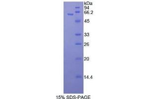 SDS-PAGE analysis of Human MAP2K4 Protein. (MAP2K4 Protein)