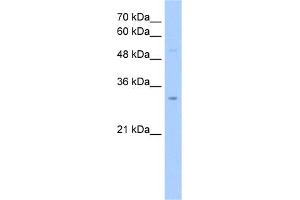 WB Suggested Anti-NSUN5C Antibody Titration:  2.
