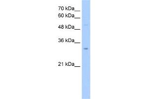 WB Suggested Anti-NSUN5C Antibody Titration:  2. (NSUN5P2 antibody  (Middle Region))