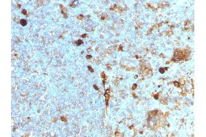 Formalin-fixed, paraffin-embedded human Tonsil stained with Alpha-1-Antitrypsin Mouse Monoclonal Antibody (AAT/1378). (SERPINA1 antibody)