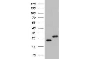 Image no. 1 for anti-Ubiquitin-Conjugating Enzyme E2E 3 (UBE2E3) antibody (ABIN1501628) (UBE2E3 antibody)