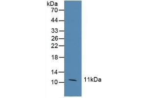 Detection of CCL6 in Human Hela Cells using Polyclonal Antibody to Chemokine (C-C motif) ligand 6 (CCL6) (CCL6 antibody  (AA 21-115))