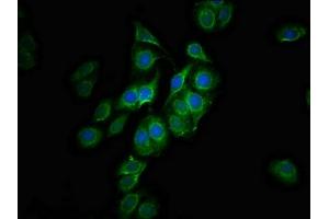 Immunofluorescence staining of HepG2 cells with ABIN7147479 at 1:100, counter-stained with DAPI. (GLTPD1 antibody  (AA 1-214))