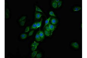 Immunofluorescence staining of HepG2 cells with ABIN7147479 at 1:100, counter-stained with DAPI.