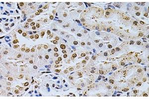 Immunohistochemistry of paraffin-embedded Rat kidney using MDM2 Polyclonal Antibody at dilution of 1:200 (40x lens). (MDM2 antibody)