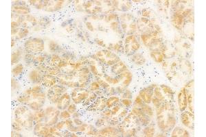 ABIN6264828 and ABIN6278632 at 1/100 staining human normal kidney tissue by IHC-P.