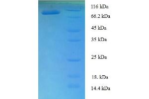 SDS-PAGE (SDS) image for T-Box 18 (TBX18) (AA 1-607), (full length) protein (His-SUMO Tag) (ABIN4975875) (T-Box 18 Protein (TBX18) (AA 1-607, full length) (His-SUMO Tag))