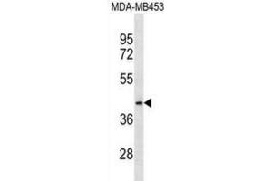 Western Blotting (WB) image for anti-Mitochondrial Ribosomal Protein L46 (MRPL46) antibody (ABIN3000730)
