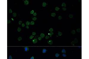 Immunofluorescence analysis of THP-1 cells using CHAT Polyclonal Antibody at dilution of 1:100. (Choline Acetyltransferase antibody)
