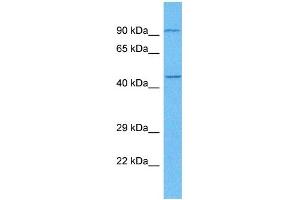 Host:  Rabbit  Target Name:  E2F3  Sample Tissue:  Human Lung Tumor  Antibody Dilution:  1ug/ml (E2F3 antibody  (C-Term))