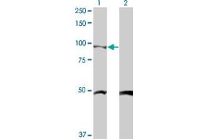 Western Blot analysis of CTNNB1 expression in transfected 293T cell line by CTNNB1 monoclonal antibody (M03), clone 4F2. (CTNNB1 antibody  (AA 682-781))
