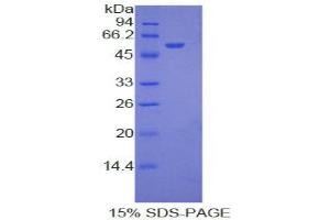SDS-PAGE analysis of Rat Ephrin A4 Protein. (EFNA4 Protein)