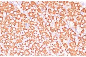 Immunohistochemistry of paraffin-embedded Rat ovary using MAP2K3 Polyclonal Antibody at dilution of 1:100 (40x lens). (MAP2K3 antibody)