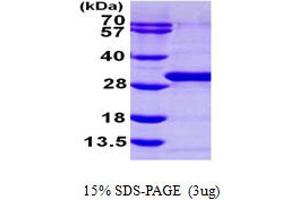 RAB21 Protein (AA 18-222) (His tag)