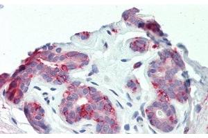 Detection of ITGb6 in Human Breast Tissue using Polyclonal Antibody to Integrin Beta 6 (ITGb6) (ITGB6 antibody  (AA 131-371))