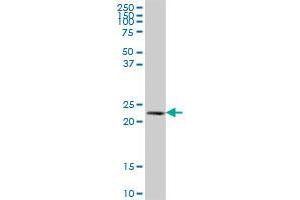 NAT9 MaxPab polyclonal antibody. (NAT9 antibody  (AA 1-207))