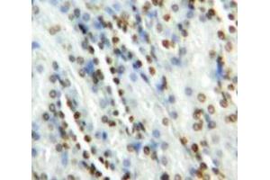 Used in DAB staining on fromalin fixed paraffin-embedded Kidney tissue (GATA2 antibody  (AA 175-480))