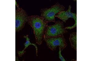 Immunofluorescence analysis of A549 cells using RAB25 mouse mAb (green). (RAB25 antibody)