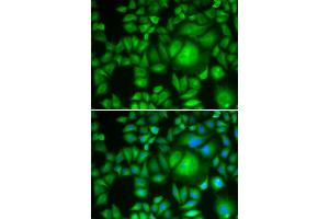 Immunofluorescence (IF) image for anti-Carbonyl Reductase 1 (CBR1) antibody (ABIN1876634) (CBR1 antibody)