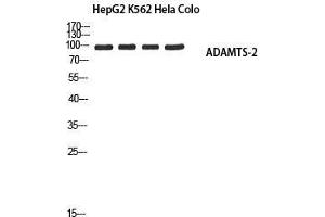 Western Blot (WB) analysis of HepG2 K562 HeLa Colo using ADAMTS-2 antibody.