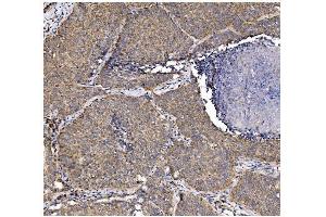 IHC analysis of PFKFB2 using anti-PFKFB2 antibody (ABIN7601627).