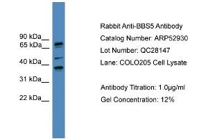 WB Suggested Anti-BBS5  Antibody Titration: 0. (BBS5 antibody  (N-Term))