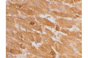 Immunohistochemical staining of human heart tissue using AP30192PU-N caspase-12 antibody (large) at 2 μg/ml. (Caspase 12 antibody  (large))