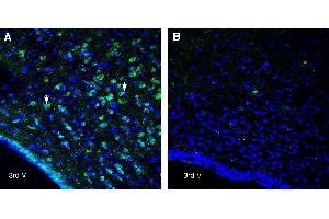 Expression of NPFFR1 in rat hypothalamusImmunohistochemical staining of perfusion-fixed frozen rat brain sections with Anti-Neuropeptide FF Receptor 1 (extracellular) Antibody (ABIN7581921), (1:400), followed by goat anti-rabbit-AlexaFluor-488. (NPFFR1 antibody  (Extracellular))
