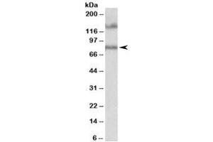 Western blot testing of human hippocampus lysate with EPB41L5 antibody at 1ug/ml. (EPB41L5 antibody)